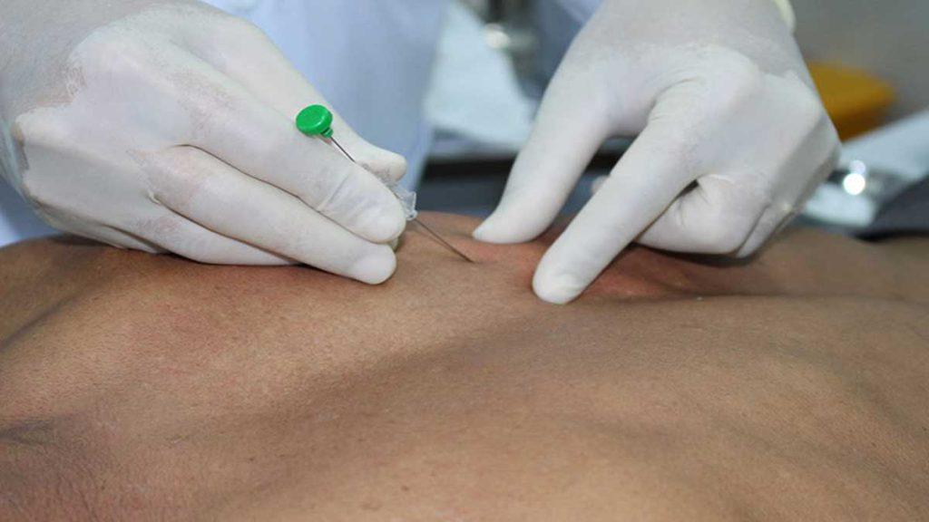 آیا همه افراد می توانند از امبدینگ برای لاغری استفاده کنند؟