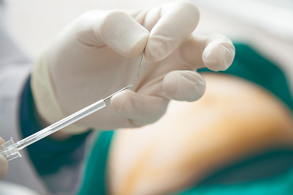 اثر امبدینگ نخ مخصوص برای چاقی های موضعی یا سلولیت