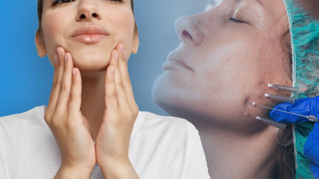 درمان ورم صورت بعد از لیفت با نخ