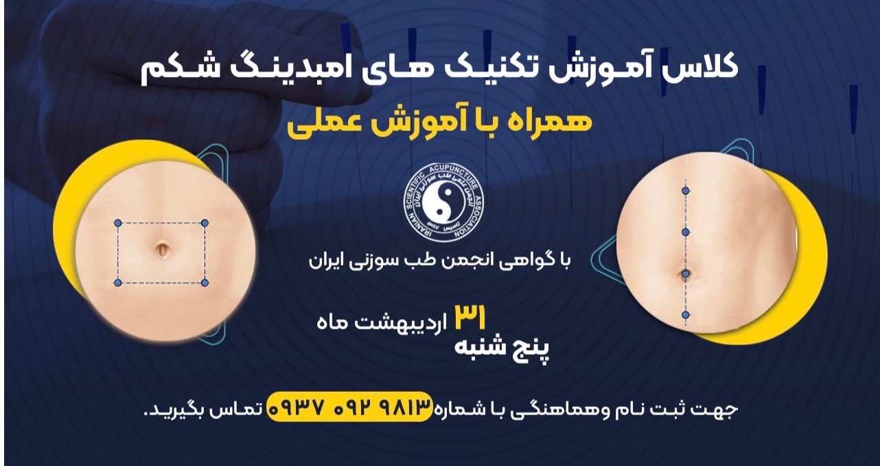 امبدینگ